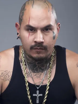 Scar