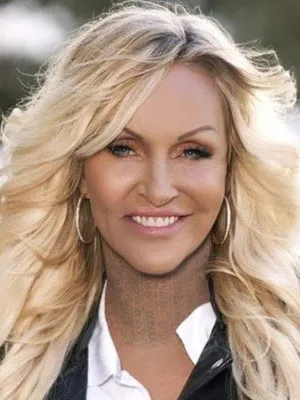 Linse Kessler