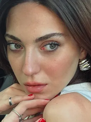 Merve Honca