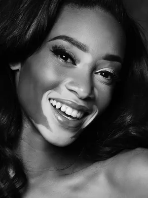 Winnie Harlow