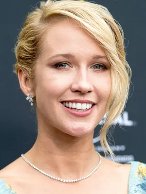 Anna Camp